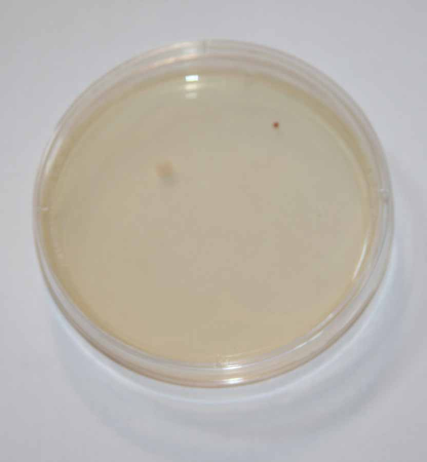 Petri Dish Results